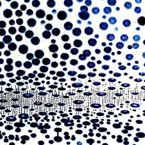 The $35 Billion Lesson: What Aschenbrenner's Option Pivot Really Tells Us About AI Infrastructure Risk